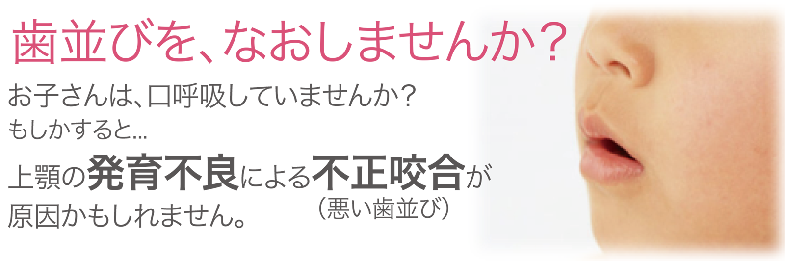 歯並びを治しませんか？お子様は、口呼吸をしていませんか？もしかすると…上顎の発育不良による不正咬合が原因かもしれません。