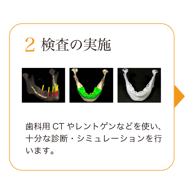 2.検査の実施。歯科用CTやレントゲンなどを使い、十分な診断・シミュレーションを行います。