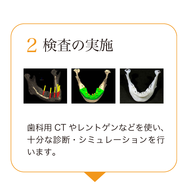2.検査の実施。歯科用CTやレントゲンなどを使い、十分な診断・シミュレーションを行います。
